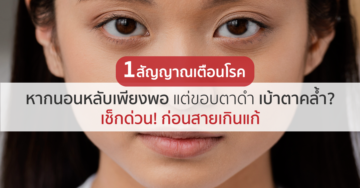 Images/Blog/0d1e859K-1สัญญาณเตือนโรค นอนพอ แต่ใต้ตาคล้ำ.png