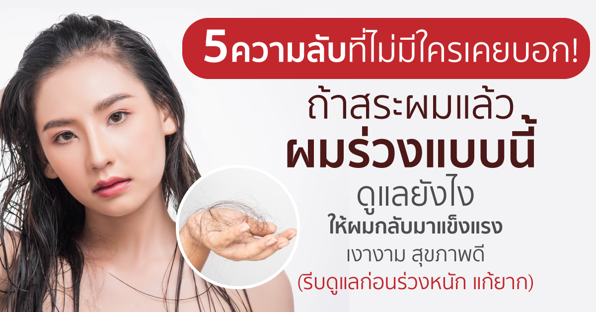 Images/Blog/SLMGg7vQ-Blog ผมร่วง.png